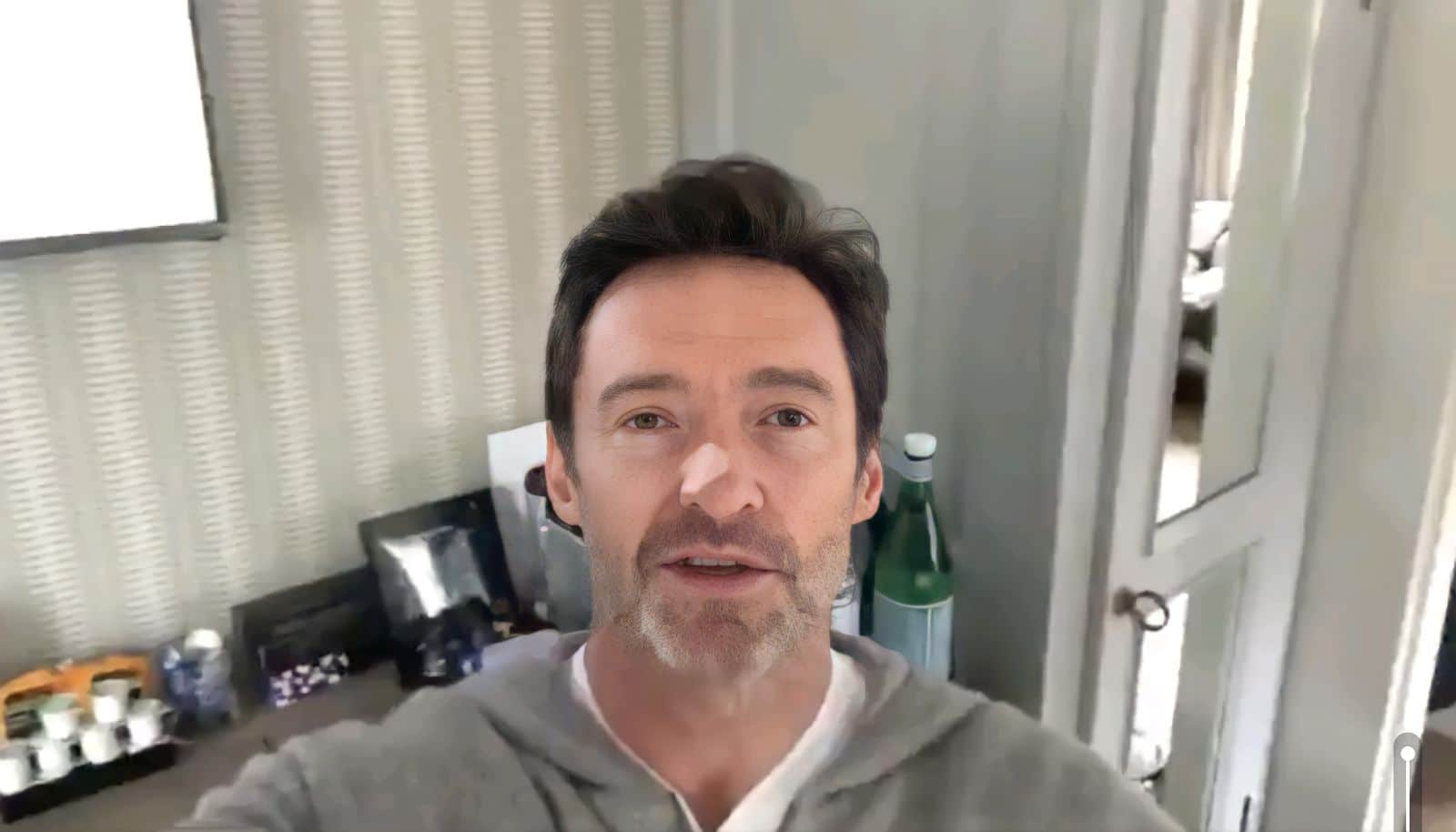 Hugh Jackman Has 2 Biopsies for Basal Cell Carcinoma hugh jackman