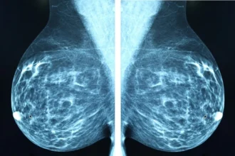 Breast Cancer Detection