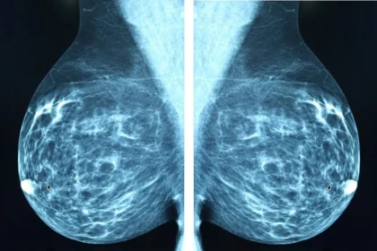 Breast Cancer Detection