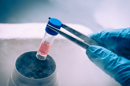 Stem Cell Therapy