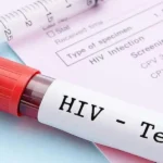 HIV