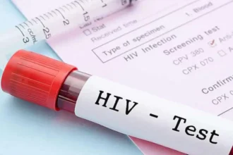 HIV