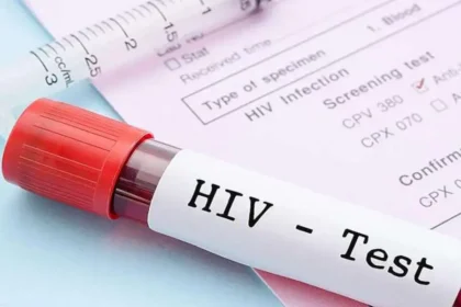 HIV