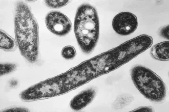 Legionnaires' Disease