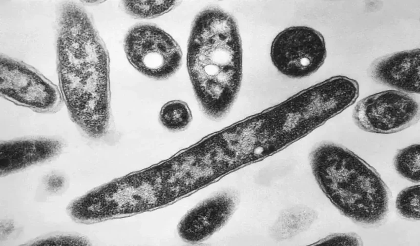 Legionnaires' Disease